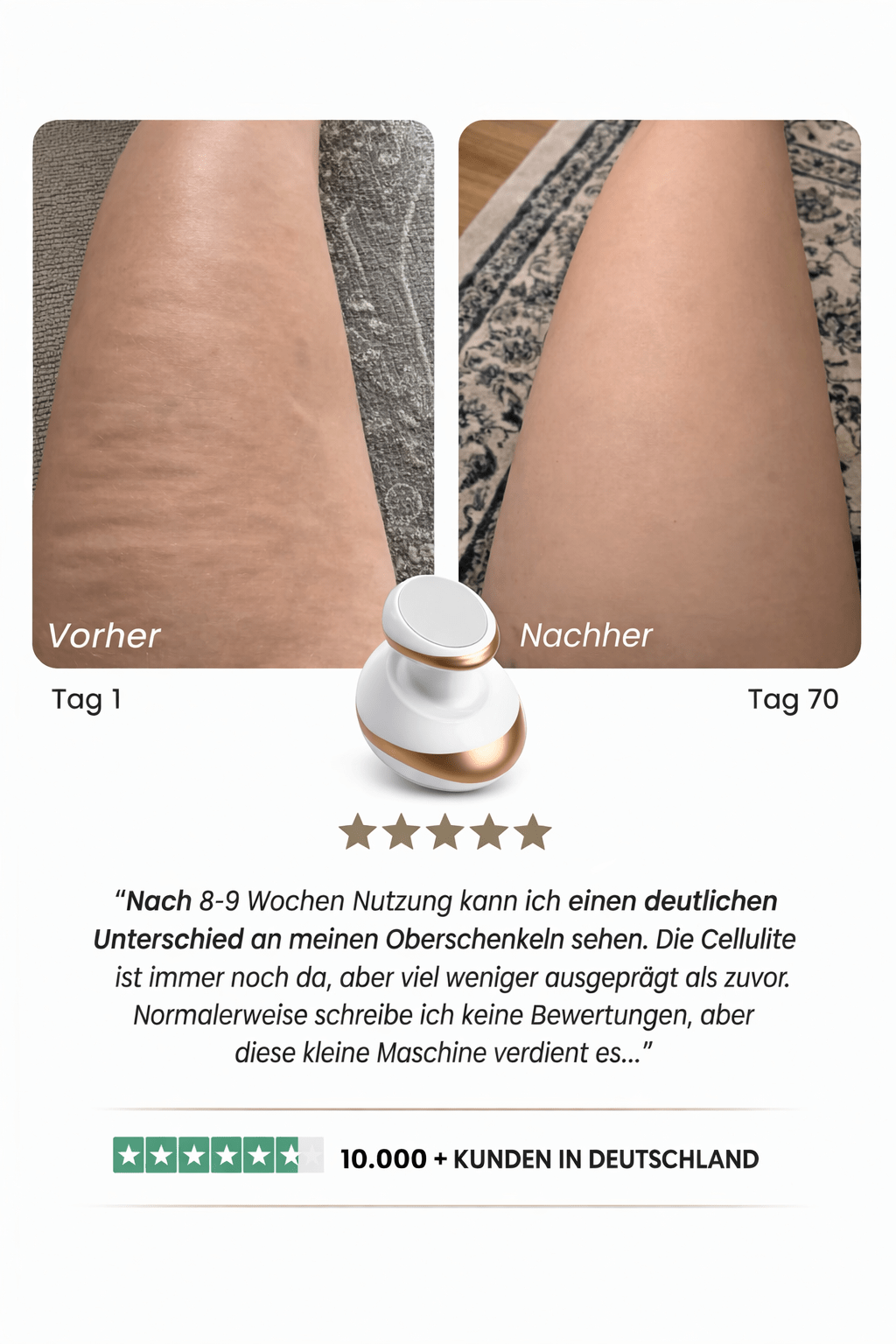 Celluviaa – glatte Haut in 14 Tagen